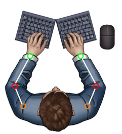 Splayed Keyboard
              Eliminates Ulnar Deviation But Can Cause Elbow Abduction -
              SeparatedKeyboards.com